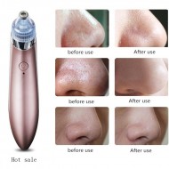 Aparat impotriva punctelor negre, de grasime, curatare ten, acnee, pori  Aden